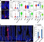 E-cadherin Antibody in Immunohistochemistry (IHC)