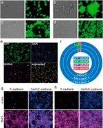 E-cadherin Antibody in Immunohistochemistry (IHC)