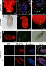E-cadherin Antibody in Immunohistochemistry (IHC)