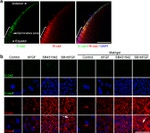 E-cadherin Antibody in Immunohistochemistry (IHC)
