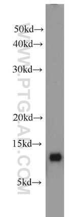 SAA2 Antibody in Western Blot (WB)