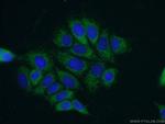 PPM1B Antibody in Immunocytochemistry (ICC/IF)