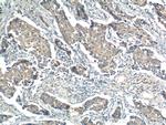 PPM1B Antibody in Immunohistochemistry (Paraffin) (IHC (P))