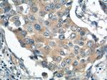 PPM1B Antibody in Immunohistochemistry (Paraffin) (IHC (P))