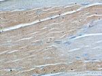PPM1B Antibody in Immunohistochemistry (Paraffin) (IHC (P))