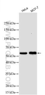 PPM1B Antibody in Western Blot (WB)