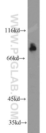 FXR1 Antibody in Western Blot (WB)