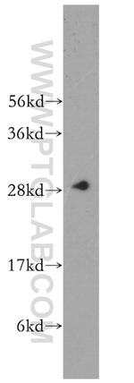 CA1 Antibody in Western Blot (WB)