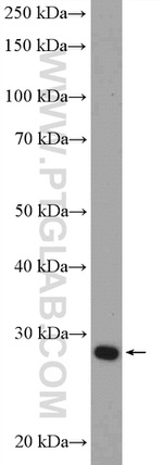 CA1 Antibody in Western Blot (WB)