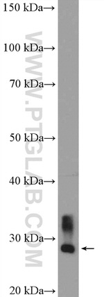 CA1 Antibody in Western Blot (WB)