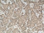 CA1 Antibody in Immunohistochemistry (Paraffin) (IHC (P))