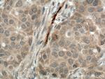 CA1 Antibody in Immunohistochemistry (Paraffin) (IHC (P))