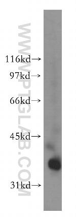 PDLIM3 Antibody in Western Blot (WB)