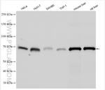 SOAT1/ACAT1 Antibody in Western Blot (WB)