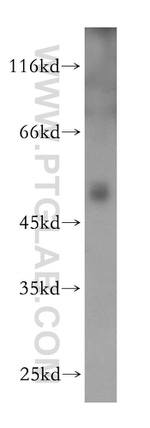RORC Antibody in Western Blot (WB)