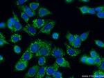 AK3L1 Antibody in Immunocytochemistry (ICC/IF)