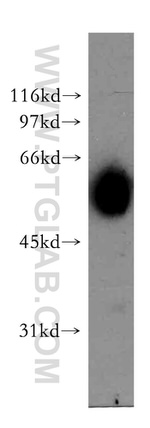 AKR7A3 Antibody in Western Blot (WB)