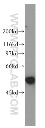 AKR7A3 Antibody in Western Blot (WB)