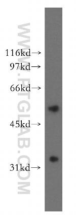 AKR7A3 Antibody in Western Blot (WB)