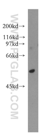 AKR7A3 Antibody in Western Blot (WB)
