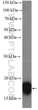 PPP3R1 Antibody in Western Blot (WB)