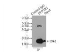 PPP3R1 Antibody in Immunoprecipitation (IP)