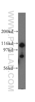 UBA6 Antibody in Western Blot (WB)