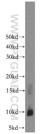 CARTPT Antibody in Western Blot (WB)