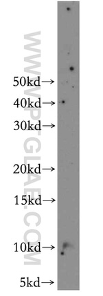 CARTPT Antibody in Western Blot (WB)