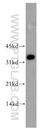 ARH Antibody in Western Blot (WB)