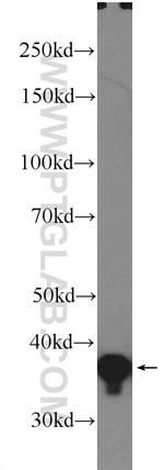 ARH Antibody in Western Blot (WB)