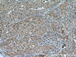 ARH Antibody in Immunohistochemistry (Paraffin) (IHC (P))