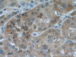 ARH Antibody in Immunohistochemistry (Paraffin) (IHC (P))