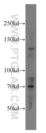 RPGRIP1 Antibody in Western Blot (WB)