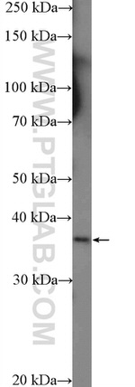 RFPL1/2/3 Antibody in Western Blot (WB)
