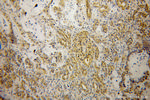 PIP4K2B Antibody in Immunohistochemistry (Paraffin) (IHC (P))