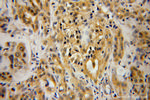 PIP4K2B Antibody in Immunohistochemistry (Paraffin) (IHC (P))