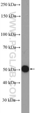 PACSIN1 Antibody in Western Blot (WB)