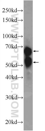 GBP5 Antibody in Western Blot (WB)