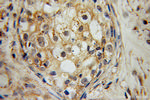 RAMP2 Antibody in Immunohistochemistry (Paraffin) (IHC (P))