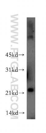 MYL4 Antibody in Western Blot (WB)