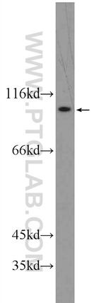 ATP12A Antibody in Western Blot (WB)