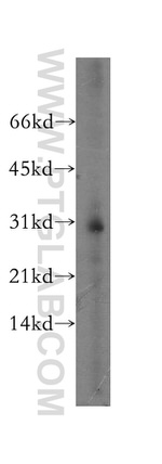 ATP6V1E2 Antibody in Western Blot (WB)