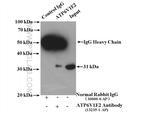 ATP6V1E2 Antibody in Immunoprecipitation (IP)