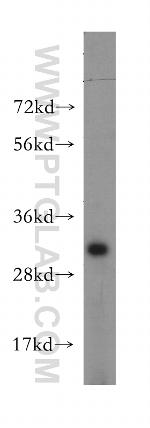 ATP6V1E2 Antibody in Western Blot (WB)