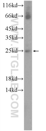 NMNAT3 Antibody in Western Blot (WB)