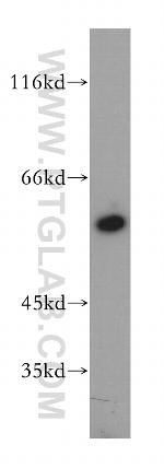 DPYS Antibody in Western Blot (WB)