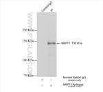 NBPF1 Antibody in Immunoprecipitation (IP)
