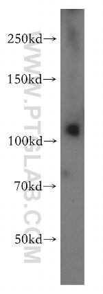 PI4KB Antibody in Western Blot (WB)