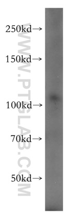PI4KB Antibody in Western Blot (WB)